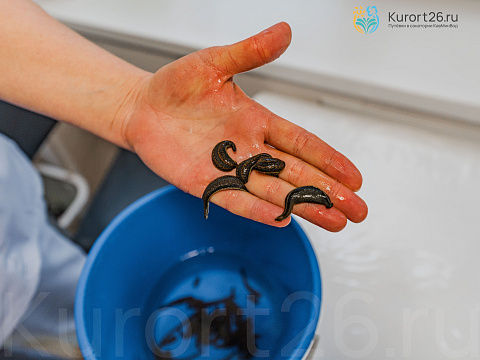 Санаторий «Машук», г. Пятигорск. Гирудотерапия